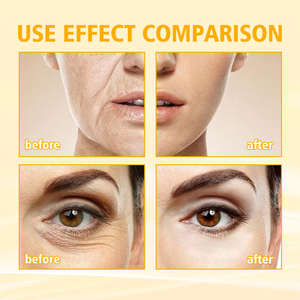 Esencia Facial Hidratante y Nutritiva con Ginseng y Niacinamida, Complejo Radiante, Reduce las Arrugas, Suministros para el Cuidado de la Salud - Product Image 2