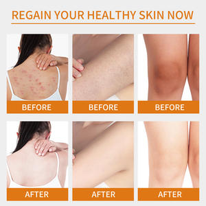 アボカドコウジ酸パパイヤ果実ボディスクラブディープクレンジング角質除去鶏皮除去500g - Product Image 4