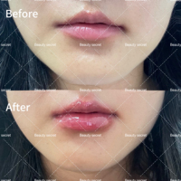 En Gros | Repulpant Lèvres au Collagène Transparent à la Noix de Coco avec Acide Hyaluronique, Sérum Brillant à Lèvres Repulpant SPF et Peptides