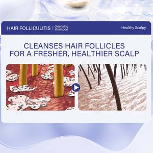 Shampooing Anti-fongique Marque Blanche Traitement Acide Salicylique pour Cuir Chevelu Gras, Dermatite Séborrhéique, Folliculite et <span class=keywords><strong>Psoriasis</strong></span> - Product Image 6