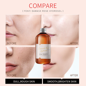 Hydrolat facial à la rose de Damas Fenyi, soin du visage, hydratant, réduit les rides et les taches, tonique 105 ml - Product Image 2
