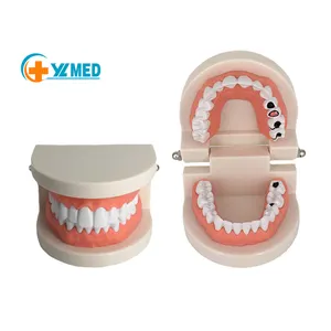 Biological Model Teaching Aids Medical Science Adult Pathology Standard Dental Teaching with Caries Tooth Model