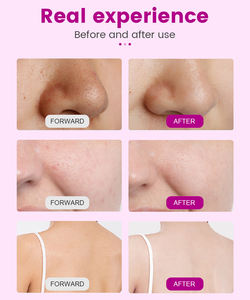 Appareil facial <span class=keywords><strong>O2</strong></span>, rajeunissement <span class=keywords><strong>de</strong></span> la peau, resserrement du visage, dermabrasion, appareil facial - Product Image 5