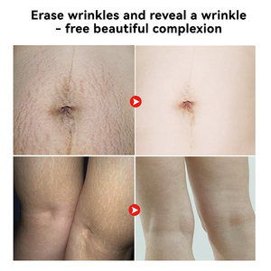 Minyak <span class=keywords><strong>Bio</strong></span> MULAN untuk Stretch Mark, Losion Penghilang Stretch Mark, Melembapkan, Menutrisi, Memperbaiki, Minyak Stretch Mark - Product Image 5
