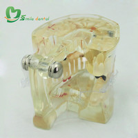 Modelo de Dientes para Patología, Modelo de Estudio Dental