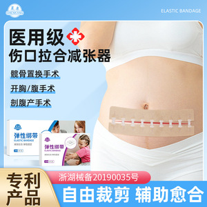 Chen Kang Medical Tension Reducing Patch Transparent Sutureless Zipper Type For Cesarean And Thyroid Surgery Wound Healing - Product Image 4