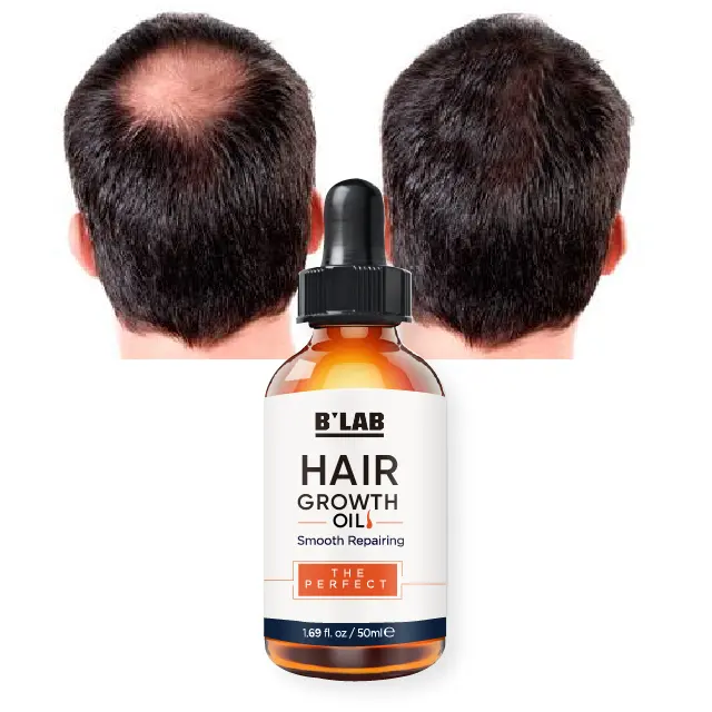 Private Label factory price hair growth oil hair serum for women & men