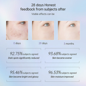 Commercio all'ingrosso Private Label organico coreano cura della pelle idratante acido ialuronico retinolo siero Anti invecchiamento rimozione macchie scure per il viso - Product Image 6