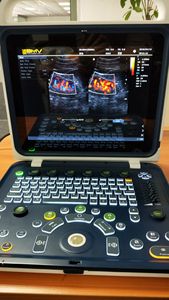 Systeme d'echographie vétérinaire di động định dạng ordinateur Avec DOPPLER COULEUR universel - Product Image 4