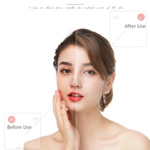 Equipo de Belleza para Uso Doméstico Más Vendido, Dispositivo para Eliminar Manchas Oscuras, Removedor de Puntos Negros Eléctrico al Vacío - Product Image 6