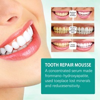 West&Month Mousse dentifrice blanchissante pour l'élimination des taches, la protection des gencives, l'haleine fraîche et le nettoyage buccal