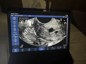 Dos Versiones de Sonda Endocavitaria Ginecológica Inalámbrica DMU92, Sonda de Ultrasonido Doppler Color para Diagnóstico Ginecológico Humano - Product Image 3