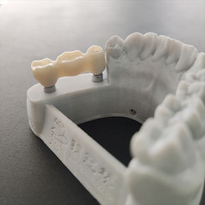 3d Printer Hybride Zirkonia Kronen En Brug Tandheelkundige Implantaat Met Titanium <span class=keywords><strong>Abutment</strong></span> - Product Image 5