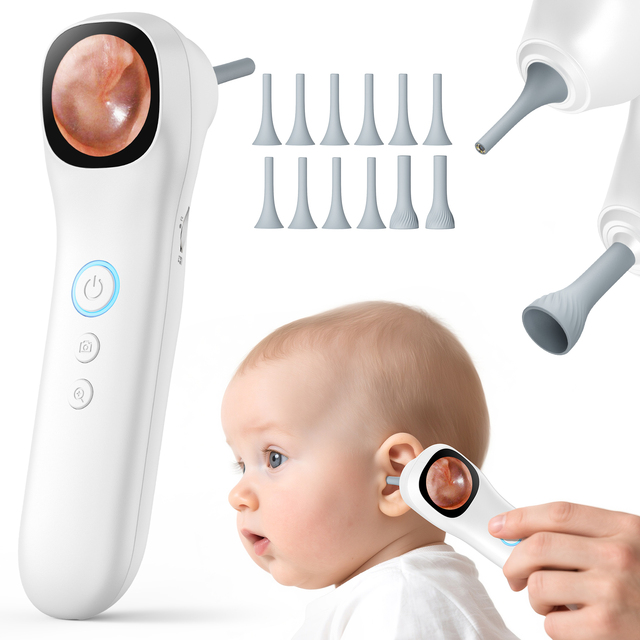 Q12 EAR Camera with 1080P HD Screen 2MP Ear 3.2mm Diameter and 1.38inch Removing Ear Wax 1000mAh