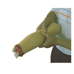 Médico Chinon avanzada Venipuncure formación muslo, modelo de la amputación de la pierna - Product Image 5