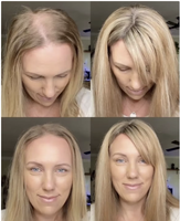 Perruque médicale en soie brun clair, cheveux humains vierges chinois, sans colle, entièrement nouée à la main 5x5 avec bande antidérapante en silicone