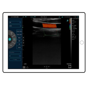 <span class=keywords><strong>Sonde</strong></span> linéaire et cardiaque convexe à ultrasons sans fil 2 en 1 avec mode Pw pour les cliniques hospitalières - Product Image 6