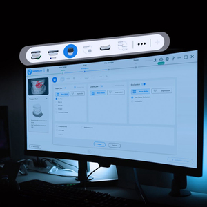 Escáner <span class=keywords><strong>3D</strong></span> <span class=keywords><strong>Shining</strong></span> AutoScan DS EX PRO (H), Escáner <span class=keywords><strong>3D</strong></span> <span class=keywords><strong>Shining</strong></span> <span class=keywords><strong>Intraoral</strong></span> - Product Image 5