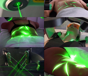 Appareil de réduction de graisse au laser Glaser indolore de pointe, lumière rouge 635nm et verte 532nm, machine amincissante corps entier, zéro temps de récupération - Product Image 2