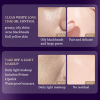 Natural Deluxe Meilleur nettoyant visage anti-âge pour la peau des rougeurs pour les peaux grasses sujettes à l'acné 100% Nettoyant visage naturel