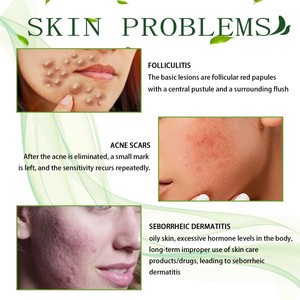 Crème <span class=keywords><strong>pour</strong></span> le visage South Moon Collagen Vitamine <span class=keywords><strong>hydratante</strong></span> anti-âge, anti-acné et anti-taches, éclaircissante et correctrice - Product Image 5