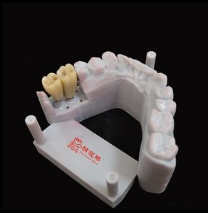 Couronnes d'implants avec excellente prothèse <span class=keywords><strong>dentaire</strong></span> plus confortables et plus belles que les prothèses et les ponts mobiles traditionnels - Product Image 3