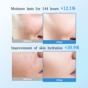 Kırışıklık yüz Serum peptid hyaluronik asit cilt bakımı onarım yağı için bir kore özel etiket organik doğal cilt bakım ürünleri - Product Image 4