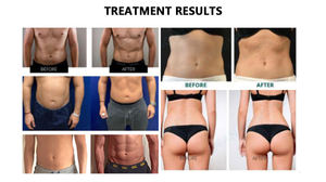 Dispositivo EMS Profesional de Escritorio de 3000w con 2 Manijas, Dispositivo Electromagnético para Adelgazar y Moldear el Cuerpo, para Adelgazar Músculos - Product Image 6