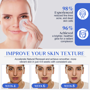 60 Gezichtsreiniging Exfoliërende Wattenschijfjes Anti Acne Glycolzuur Schil Gezichtspads Patch Voor Een Jeugdig Ogende Huid - Product Image 4