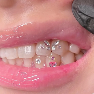 Bellezza diamante farfalla dentaria cristallo gioielli gioielli cristalli pietra dente gemma sorriso splendido - Product Image 5