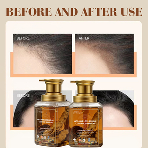 Fabricant chinois de shampooing anti-perte de <span class=keywords><strong>cheveux</strong></span> pour <span class=keywords><strong>cheveux</strong></span> <span class=keywords><strong>bouclés</strong></span> <span class=keywords><strong>et</strong></span> abîmés Fonction de promotion <span class=keywords><strong>et</strong></span> de prévention de la croissance des <span class=keywords><strong>cheveux</strong></span> - Product Image 2