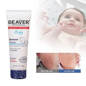 Vendita calda naturale organico pannolino rash cream per il bambino sensibile pelle guarigione unguento lozione per il corpo pannolino per bambini Rash Cream