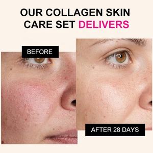 Oem Odm Anti-Aging Reafirmante Colágeno 4 piezas Cuidado de la piel de las mujeres Set Colágeno Cuidado de la cara <span class=keywords><strong>Kit</strong></span> - Product Image 4