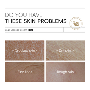 Crème Visage à la Bave d'Escargot 25g, Faible MOQ, Marque Privée, Crème Avancée au Mucin d'Escargot, Essence Concentrée au Mucin d'Escargot, Vente en Gros - Product Image 4