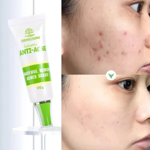 Bellezza biologica sbiancamento notte viso Anti Acne e brufolo sbiancamento Acne crema di rimozione per il viso - Product Image 1