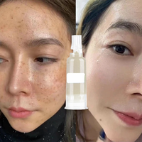 Traitement Anti-Taches Visage Hyperpigmentation, Mélasma et Taches de Rousseur: Crème Éliminatrice de Taches Foncées pour le Soin de la Peau à Base de Spicules d'Éponge