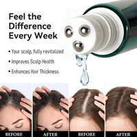 Traitement Anti-Chute Capillaire : Sérum Croissance Cheveux et Soin du Cuir Chevelu à la Biotine, Zinc, PCA, Niacinamide, Romarin, Caféine, PDRN, Spicule et 9 Peptides