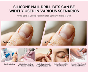 Evolisse - Brocas de Silicona de Alta Gama para Uñas, Herramientas de Pedicura para Pulir los <span class=keywords><strong>Pies</strong></span>, Lijadora para <span class=keywords><strong>Pies</strong></span>, Eliminación de Cutículas y Piel Muerta - Product Image 5