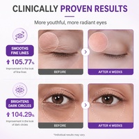 Crème Contour des Yeux Personnalisée Multi-Peptides NAD+ Rétinol Revitalisante et Repulpante pour un Effet Jeunesse Durable – Vente en Gros OEM