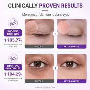 Crema <span class=keywords><strong>Contorno</strong></span> <span class=keywords><strong>de</strong></span> <span class=keywords><strong>Ojos</strong></span> Personalizada con Múltiples Péptidos, NAD+ y Retinol, Revitalizante, Rellena y Reafirma la Piel Flácida del <span class=keywords><strong>Contorno</strong></span> <span class=keywords><strong>de</strong></span> <span class=keywords><strong>Ojos</strong></span>, para un Brillo Juvenil Duradero, Venta al Por Mayor OEM - Product Image 3
