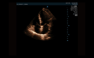 Échographe Doppler Couleur Mindary Z.One PRO sur Chariot pour Usage Vétérinaire avec Échographie et Diagnostic Ultrasonore Haute Définition - Product Image 6