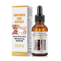 Sérum Éclaircissant Anti-Taches MOIKA pour le Visage, les Genoux et les Chevilles, Version Anglaise Originale 30ml