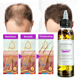 Private Label <strong>Hair</strong> Loss Regrowth Growing <strong>Oils</strong> Treatments <strong>Biotin</strong> Herbal Nattural Nourishing <strong>for</strong> Rapid <strong>Hair</strong> Growth <strong>Oil</strong> Wholesale - Product Image 3