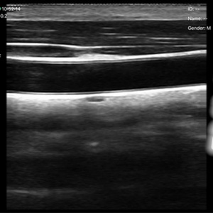 เครื่องอัลตราซาวนด์ไร้สายแบบพกพา 128 อีลิเมนต์ หัวตรวจอัลตราซาวนด์แบบ Linear 7.5MHz ราคาดี รุ่น BW12 - Product Image 5