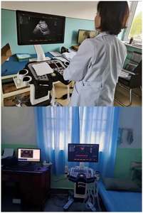 नई डावी ब्रांड DW-F3 ट्रॉली रंग डोप्लर अल्ट्रासाउंड हृदय गर्भावस्था - Product Image 5