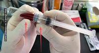 Emballage de seringue en verre à double chambre de qualité médicale supérieure avec tige de piston