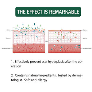 4cm * 150cm Confortable Respirant Sécurité Plâtre Chinois Cicatrice Silicone Cicatrice Feuilles - Product Image 2