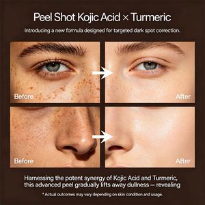 Sérum Visage Éclaircissant Bio à l'Acide Kojique Marque Blanche Exfoliant Élimine les Cellules Mortes, les Points Noirs et les Imperfections en Profondeur - Product Image 2