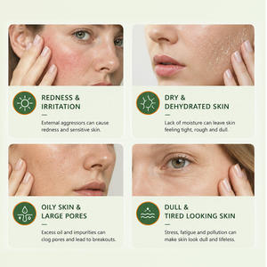 Gel Hidratante Personalizado OEM con 15% de Aloe Vera para Después del Sol, Calmante e Hidratante para Rostro y Cuerpo GREENLEM - Product Image 3