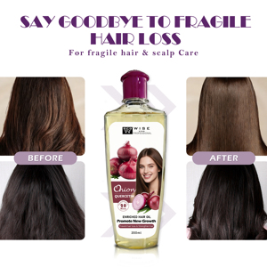 Aceite para el Crecimiento del Cabello a Base de Cebolla, Anticaída, Fortalece las Raíces del Cabello, Nutre el Cuero Cabelludo, Tratamiento con Ingredientes Naturales para Cabello Grueso, 200 ml - Product Image 6